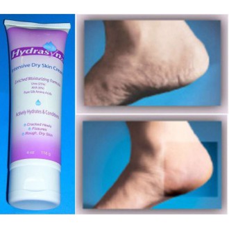 dr scholl's dreamwalk foot cream